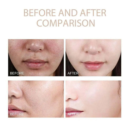 Dr. Melaxin Peel shot Glow rice ampoule duo - your secret to radiant skin